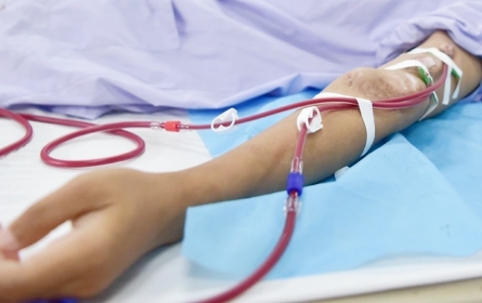 Suy thận ở tuổi 32 sau nhiều năm lạm dụng sản phẩm tăng cơ 1 Suy thận ở tuổi 32 sau nhiều năm lạm dụng sản phẩm tăng cơ